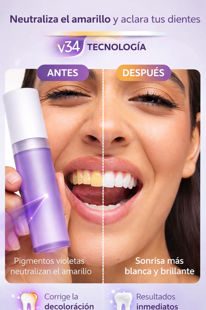 BLANQUEADOR DENTAL V34